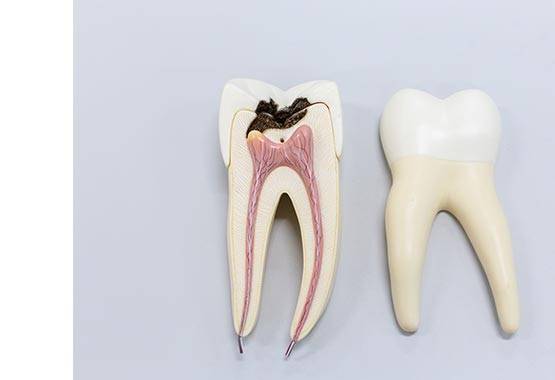 Эндодонтия