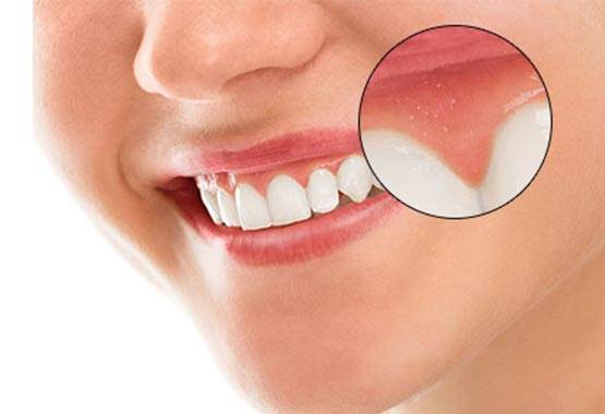 Парадонтология